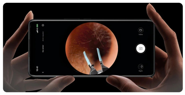 Otoskop z kamerą do czyszczenia uszu BEBIRD Note5 Pro z żyroskopem, 10 MP, biały