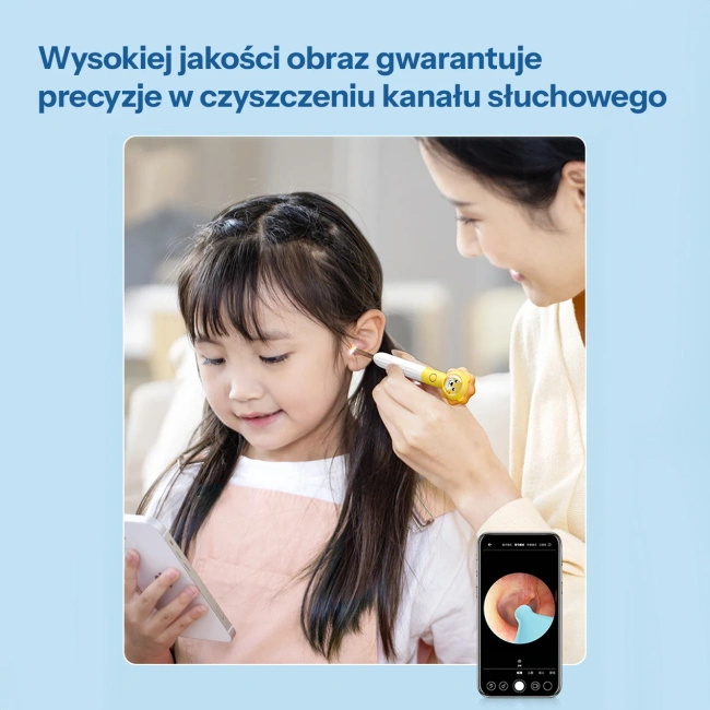 Otoskop z kamerą Bebird XLife Q3 do czyszczenia uszu, z żyroskopem, żółty